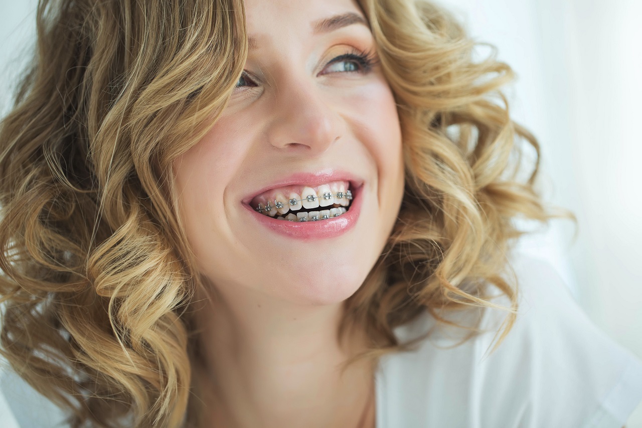 W jakim przypadku warto podjąć decyzję o założeniu aparatu ortodontycznego?